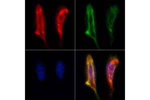 ABIN6260239 and ABIN6273094 staining Hela by IF/ICC.