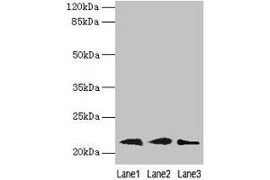 Western blot All lanes: RAP1B antibody at 0. (RAP1B 抗体  (AA 1-181))