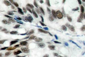 Image no. 1 for anti-Retinoblastoma 1 (RB1) antibody (ABIN271801) (Retinoblastoma 1 抗体)