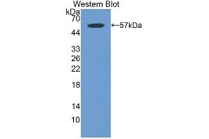 Detection of Recombinant ITGb6, Mouse using Polyclonal Antibody to Integrin Beta 6 (ITGb6) (ITGB6 抗体  (AA 131-619))