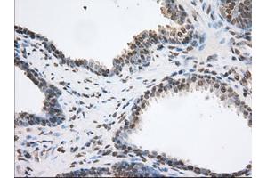Image no. 3 for anti-Transforming, Acidic Coiled-Coil Containing Protein 3 (TACC3) antibody (ABIN1498097) (TACC3 抗体)