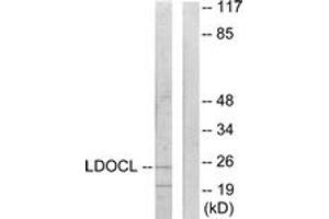 Western blot analysis of extracts from COLO205 cells, using LDOC1L Antibody. (LDOC1L 抗体  (AA 141-190))
