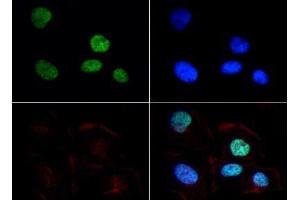 Immunofluorescence of Rabbit Anti-Histone H3 [Dimethyl Lys9] Antibody. (Histone 3 抗体  (H3K9me2))