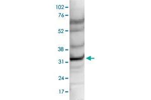 Nuclear extracts of HeLa cells (40 ug) were analysed by Western blot using CCDC101 polyclonal antibody  diluted 1 : 1,000 in TBS-Tween containing 5% skimmed milk. (SGF29 抗体)