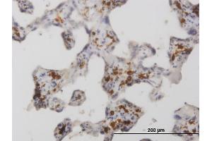 Immunoperoxidase of monoclonal antibody to MRC1 on formalin-fixed paraffin-embedded human placenta. (Macrophage Mannose Receptor 1 抗体  (AA 22-130))