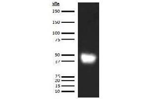 Western Blotting (WB) image for anti-Leucine-Rich alpha-2 Glycoprotein 1 (LRG1) antibody (Biotin) (ABIN5567234) (LRG1 抗体  (Biotin))