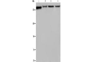 Western Blotting (WB) image for anti-Filamin A, alpha (FLNA) antibody (ABIN2423478) (Filamin A 抗体)