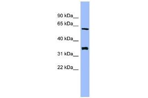WB Suggested Anti-HECA Antibody Titration: 0. (HECA 抗体  (Middle Region))