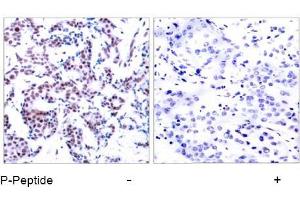 Image no. 1 for anti-Jun B Proto-Oncogene (JUNB) (pSer259) antibody (ABIN196659) (JunB 抗体  (pSer259))