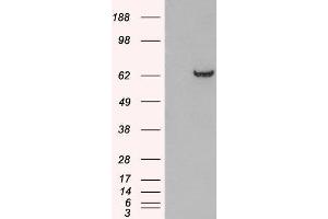 HEK293 overexpressing GRB7 and probed with ABIN2562933 (mock transfection in first lane). (GRB7 抗体  (N-Term))