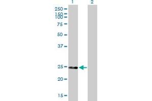 Western Blot analysis of DGCR6 expression in transfected 293T cell line by DGCR6 MaxPab polyclonal antibody. (DGCR6 抗体  (AA 1-220))