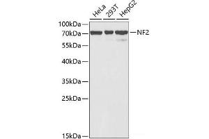 Western blot analysis of extracts of various cell lines using NF2 Polyclonal Antibody at dilution of 1:1000. (Merlin 抗体)