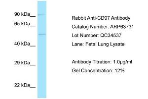 Western Blotting (WB) image for anti-CD97 (CD97) (C-Term) antibody (ABIN2789604) (CD97 抗体  (C-Term))