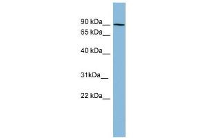 PRKCB1 antibody used at 1 ug/ml to detect target protein.