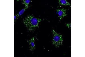 Immunofluorescence -anti-Rab7a Ab in Hepa1-6 cells at 1/50 dilution, cells were fixed With methanol, (RAB7A 抗体  (C-Term))