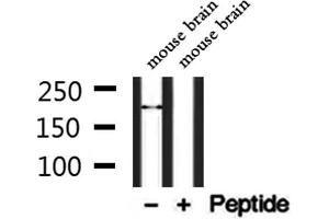 Western blot analysis of extracts from mouse brain, using TRPM2 Antibody. (TRPM2 抗体  (C-Term))