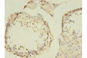 Immunohistochemistry of paraffin-embedded human testis tissue using ABIN7153493 at dilution of 1:100 (GABRB2 抗体  (AA 26-244))