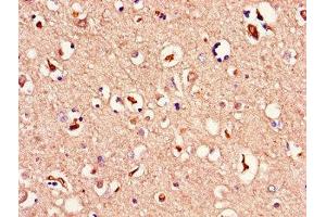 Immunohistochemistry of paraffin-embedded human brain tissue using ABIN7159976 at dilution of 1:100 (ERK2 抗体  (AA 133-316))