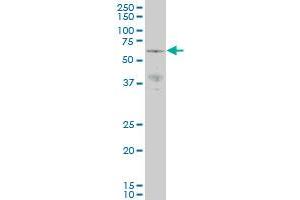 PAK3 monoclonal antibody (M07), clone 1H7 Western Blot analysis of PAK3 expression in NIH/3T3 . (PAK3 抗体  (AA 1-90))