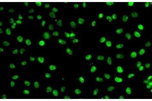 Immunofluorescence analysis of A-549 cells using PHF19 Polyclonal Antibody (PHF19 抗体)