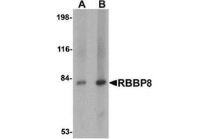 Western blot analysis of RBBP8 in mouse spleen tissue lysate with RBBP8 antibody at (A) 1 and (B) 2 μg/ml. (Retinoblastoma Binding Protein 8 抗体  (Center))