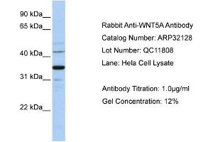 WNT5A antibody used at 1 ug/ml to detect target protein. (WNT5A 抗体  (Middle Region))