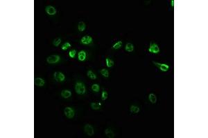 Immunofluorescence staining of Hela cells with ABIN7127714 at 1:100,counter-stained with DAPI. (Recombinant MTOR 抗体  (pSer2448))