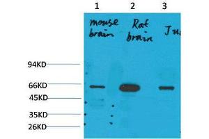 Western Blot (WB) analysis of 1) Mouse Brain Tissue, 2)Rat Brain Tissue , 3) Jurkat with KCNK10(TREK-2) Rabbit Polyclonal Antibody diluted at 1:2000. (KCNK10 抗体)