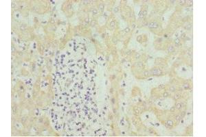 Immunohistochemistry of paraffin-embedded human liver tissue using ABIN7155995 at dilution of 1:100 (HMGCL 抗体  (AA 1-325))