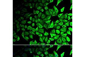 Immunofluorescence analysis of HeLa cells using DPP7 Polyclonal Antibody (DPP7 抗体)
