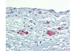 Immunohistochemistry (IHC) image for anti-SRY (Sex Determining Region Y)-Box 7 (SOX7) (Middle Region) antibody (ABIN2778378) (SOX7 抗体  (Middle Region))