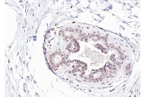 Immunohistochemistry (IHC) image for anti-Estrogen Receptor 1 (ESR1) (pTyr537) antibody (ABIN6255950)