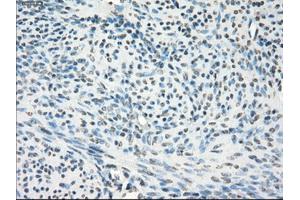 Immunohistochemical staining of paraffin-embedded pancreas tissue using anti-GBP2mouse monoclonal antibody. (GBP2 抗体)