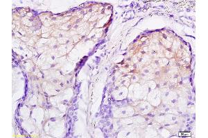 Formalin-fixed and paraffin embedded human scalp labeled with Rabbit Anti JNK2 Polyclonal Antibody, Unconjugated (ABIN681403) at 1:200 followed by conjugation to the secondary antibody and DAB staining (JNK1/2 抗体  (AA 311-424))
