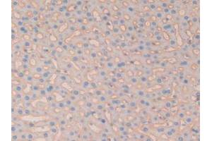 IHC-P analysis of Rat Liver Tissue, with DAB staining. (CD147 抗体  (AA 59-321))