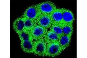 Confocal immunofluorescent analysis of CDKN2B antibody with HeLa cells followed by Alexa Fluor 488-conjugated goat anti-rabbit lgG (green).