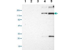 Western blot anyalysis of Lane 1: Human cell line RT-4, Lane 2: Human cell line U-251MG sp, Lane 3: Human cell line A-431, Lane 4: Human liver tissue, Lane 5: Human tonsil tissue with EMILIN1 polyclonal antibody . (Emilin1 抗体)