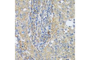 Immunohistochemistry (IHC) image for anti-Cortactin (CTTN) antibody (ABIN7266511)