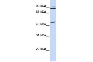 MCM9 antibody used at 1 ug/ml to detect target protein. (MCM9 抗体  (N-Term))