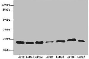 Western blot All lanes: PSMB3 antibody at 3. (PSMB3 抗体  (AA 1-205))