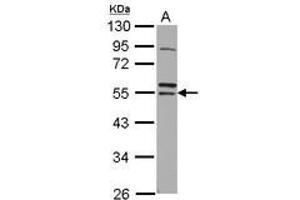 Image no. 1 for anti-Ring Finger Protein 14 (RNF14) (AA 1-260) antibody (ABIN1500719)