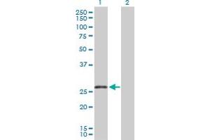 Western Blot analysis of TNFRSF13C expression in transfected 293T cell line by TNFRSF13C MaxPab polyclonal antibody. (TNFRSF13C 抗体  (AA 1-184))