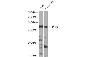 Western blot analysis of extracts of various cell lines, using NPHP3 antibody (ABIN6132967, ABIN6144770, ABIN6144771 and ABIN6224683) at 1:1000 dilution. (NPHP3 抗体  (AA 1-130))