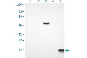 Western blot analysis of Lane 1: Human cell line RT-4 Lane 2: Human cell line U-251MG sp Lane 3: Human plasma (IgG/HSA depleted) Lane 4: Human liver tissue Lane 5: Human tonsil tissue with IFITM1 polyclonal antibody  at 1:100-1:250 dilution.