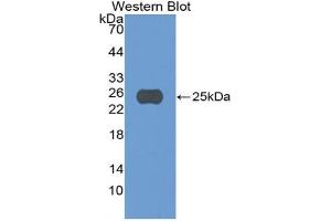 Western blot analysis of the recombinant protein. (CASP5 抗体  (AA 145-327))