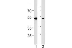 Western blot analysis of lysate from 1) HL-60 and 2) Jurkat cell line using RUNX3 antibody at 1:1000. (RUNX3 抗体  (AA 168-197))