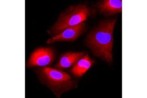Immunofluorescenitrocellulosee of human A549 cells stained with Hoechst 33342 (Blue) and monoclonal anti-human FUS2 antibody (1:500) with Texas Red (red). (NAT6 抗体  (AA 1-308))