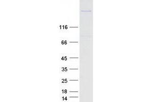 Validation with Western Blot (FER1L6 Protein (Myc-DYKDDDDK Tag))