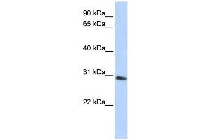 BPGM antibody used at 1 ug/ml to detect target protein. (BPGM 抗体  (C-Term))