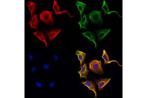 ABIN6264578 and ABIN6272979 staining Hela cells by IF/ICC. (RAB3D 抗体  (Internal Region))